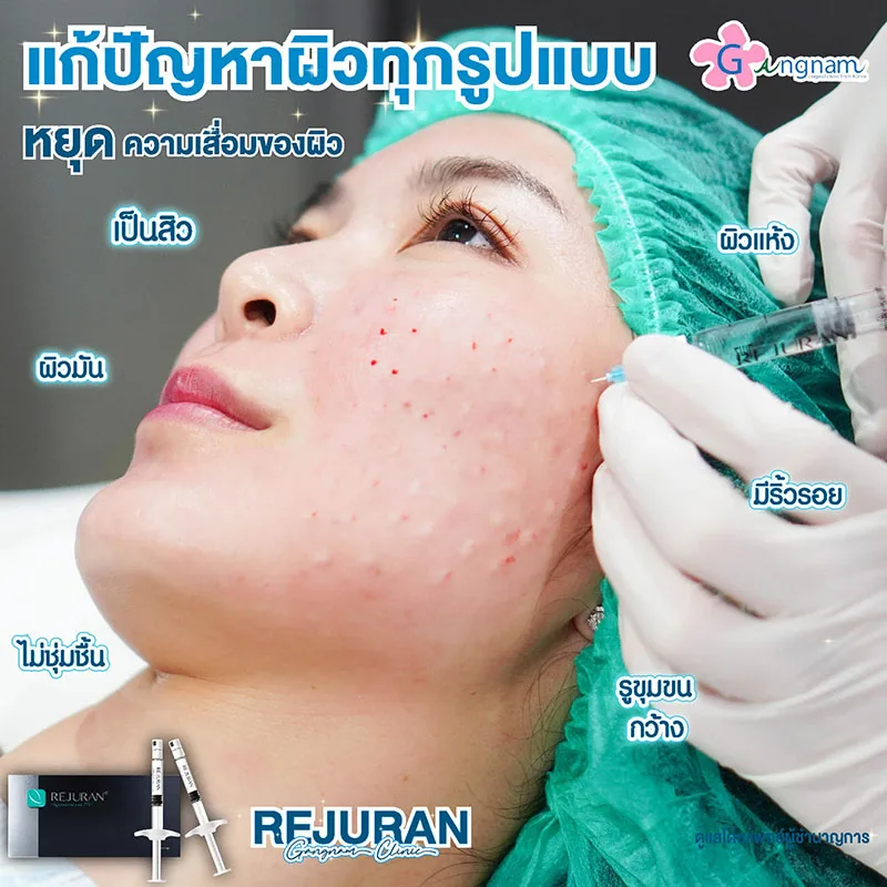 rejuran ช่วยอะไร