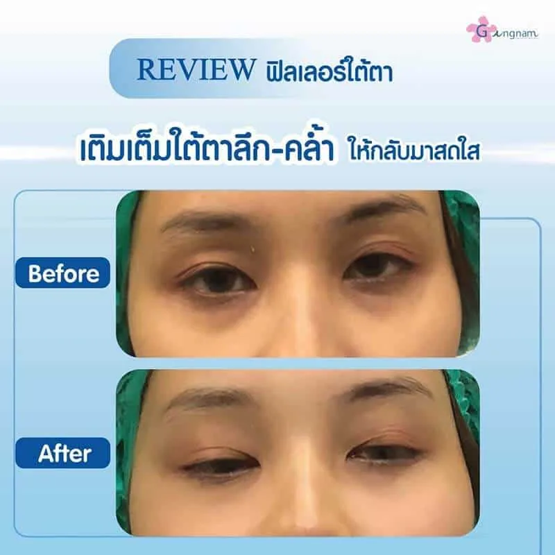 รีวิวลูกค้า 80