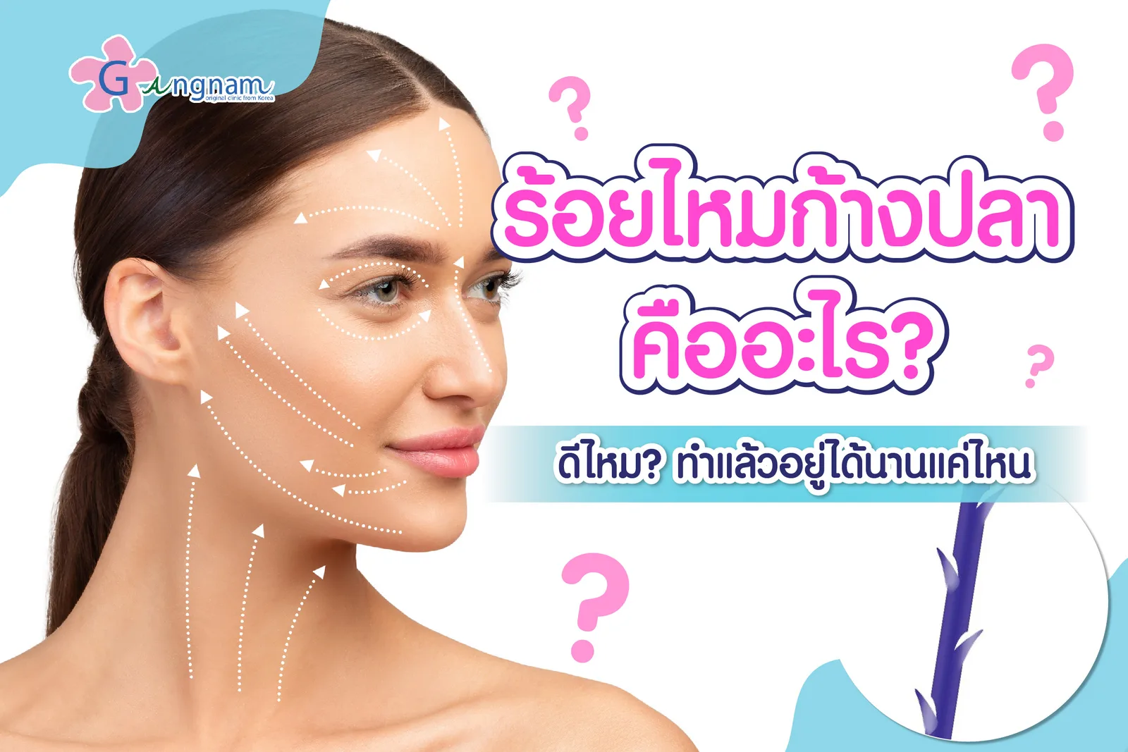 ร้อยไหมก้างปลา คืออะไร ช่วยเรื่องอะไรบ้าง พร้อมข้อควรรู้ก่อนตัดสินใจทำ