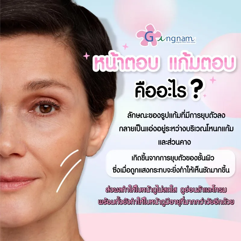 หน้าตอบ แก้มตอบ คืออะไร