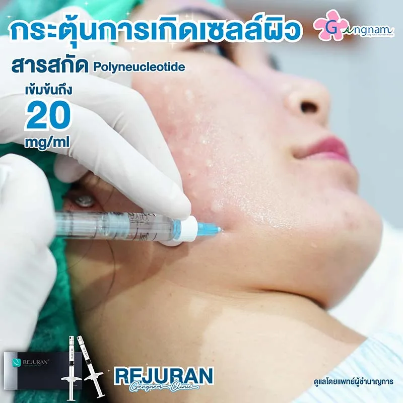 ฉีด rejuran กระตุ้นเซลล์ผิว