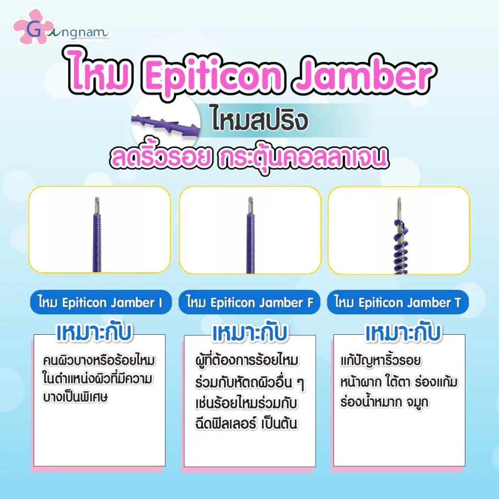 ไหม Epiticon แบบ Jamber
