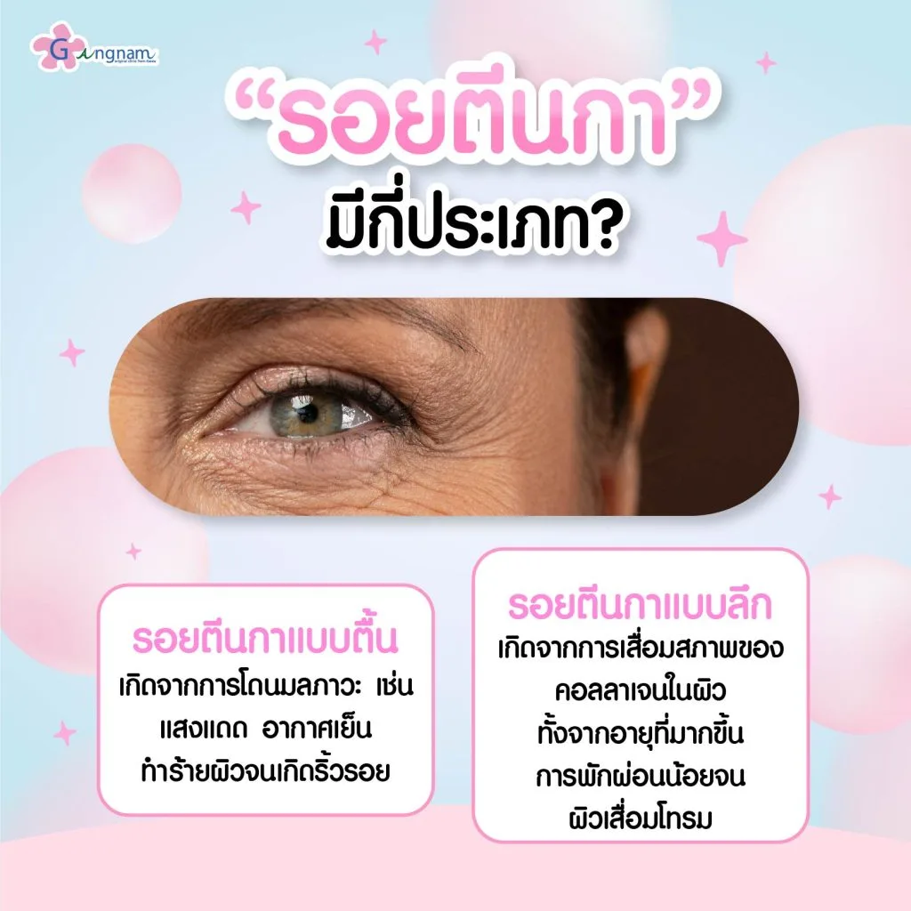 รอยตีนกามีกี่ประเภท