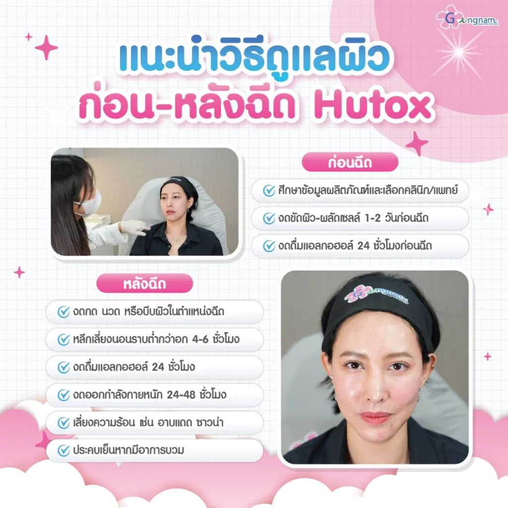 การดูแลก่อนและหลังฉีด Hutox