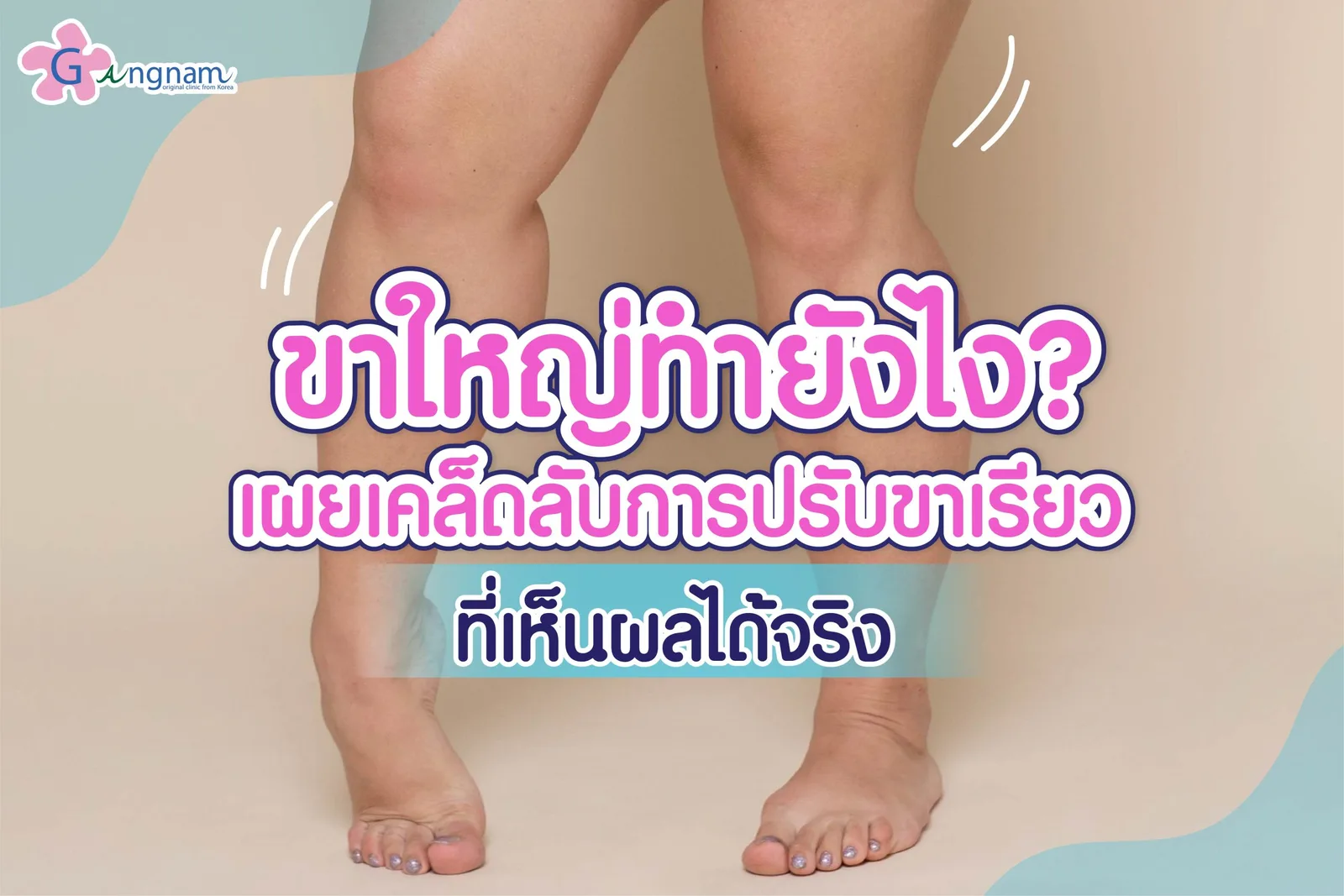 สาเหตุ ขาใหญ่ เกิดจากอะไร? มีวิธีลดขาใหญ่ อย่างไรให้ปลอดภัย แบบเร่งด่วน