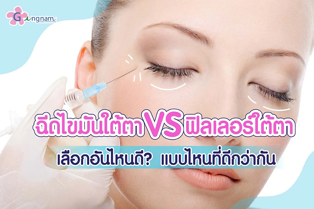 ฉีดไขมันใต้ตา VS ฟิลเลอร์ใต้ตาเลือกอันไหนดี? แบบไหนที่ดีกว่ากัน