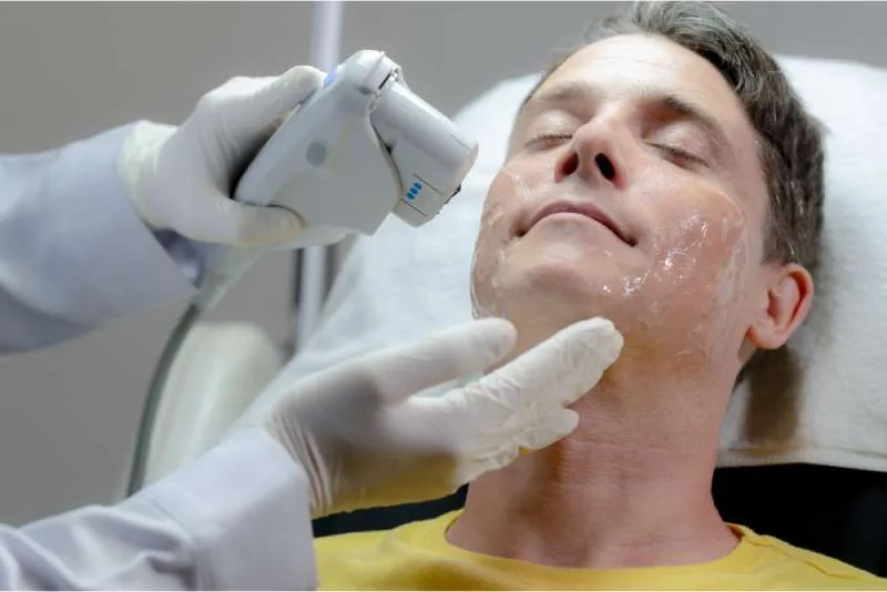 หลักการทำงานของ Thermage