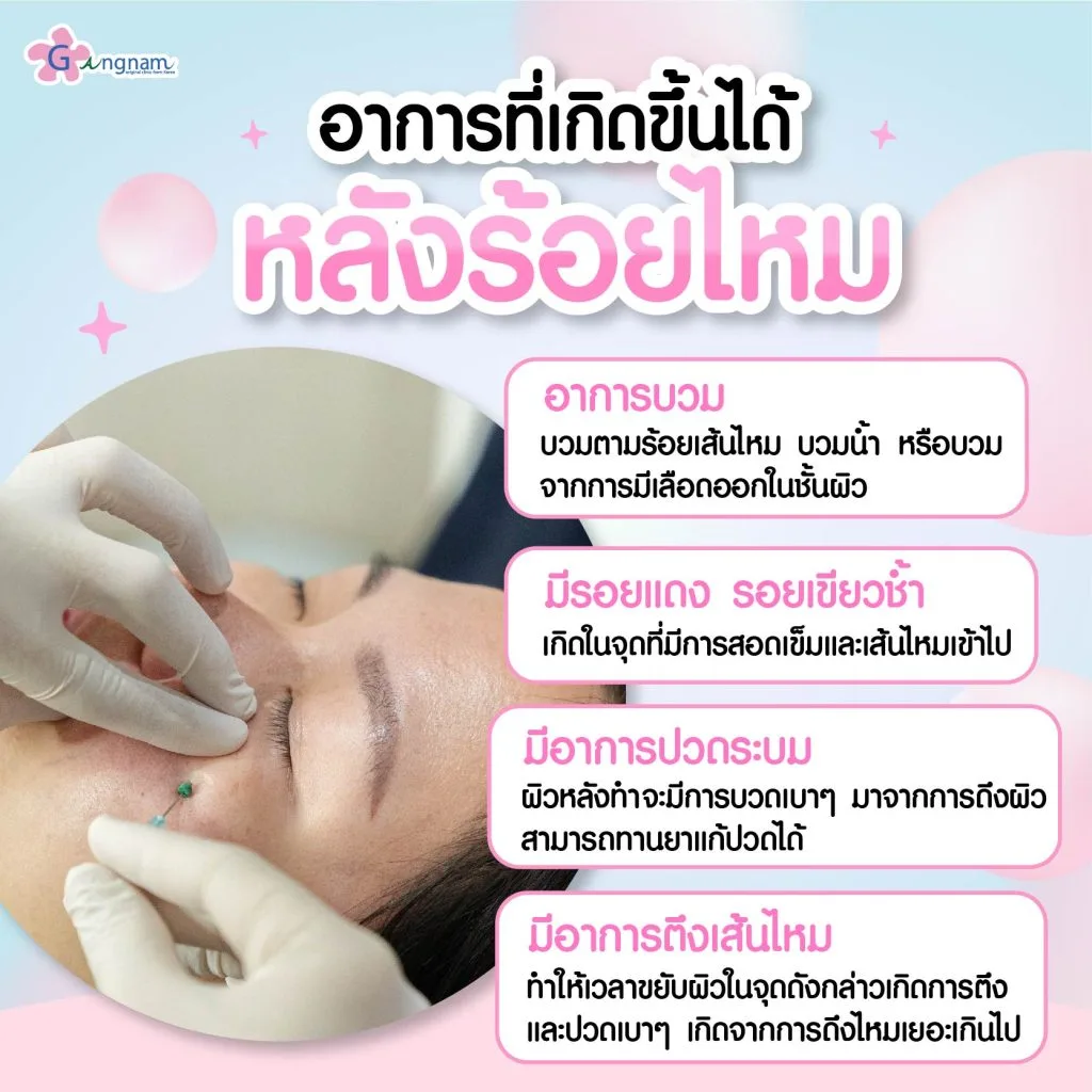 ร้อยไหมจะมีอาการอะไรบ้าง