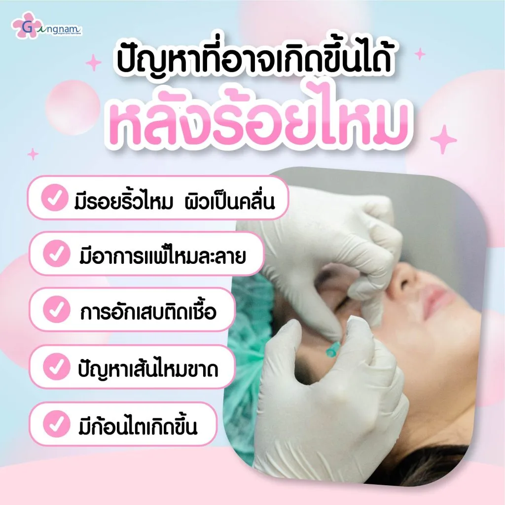 ปัญหาที่เกิดขึ้นได้หลังร้อยไหม