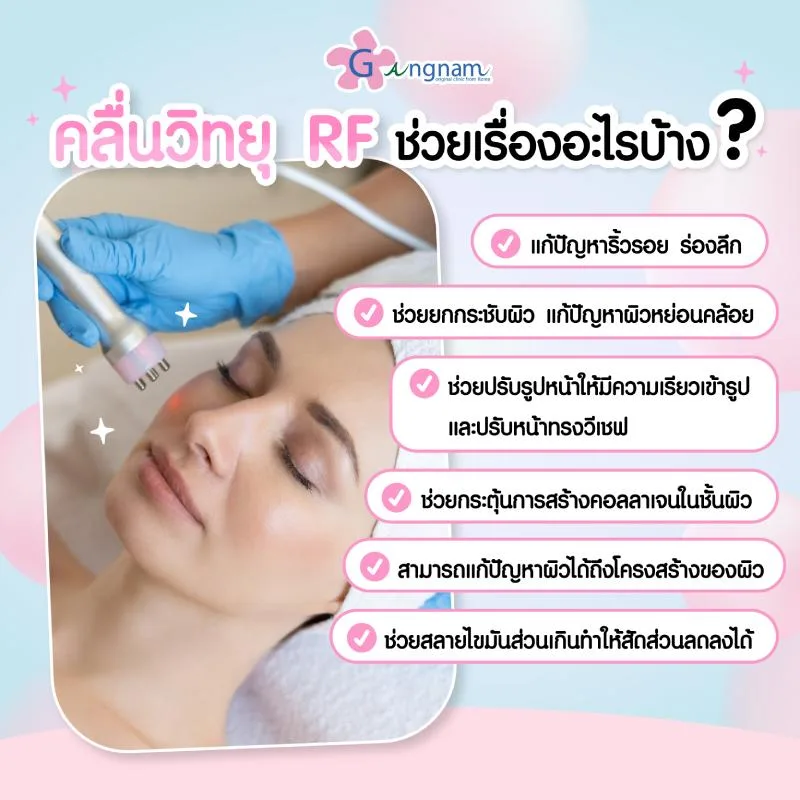 คลื่นวิทยุ RF ช่วยเรื่องไหนบ้าง