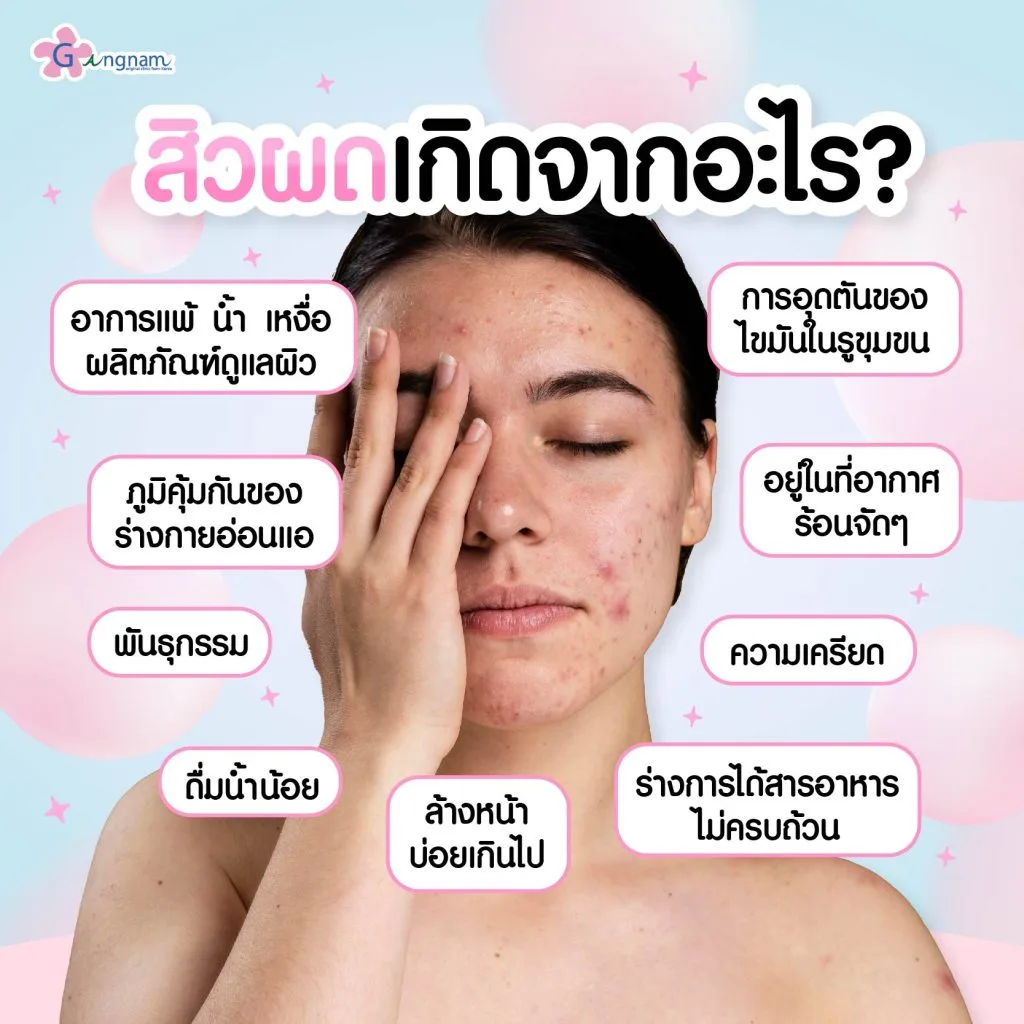 สิวผดเกิดจากอะไร?