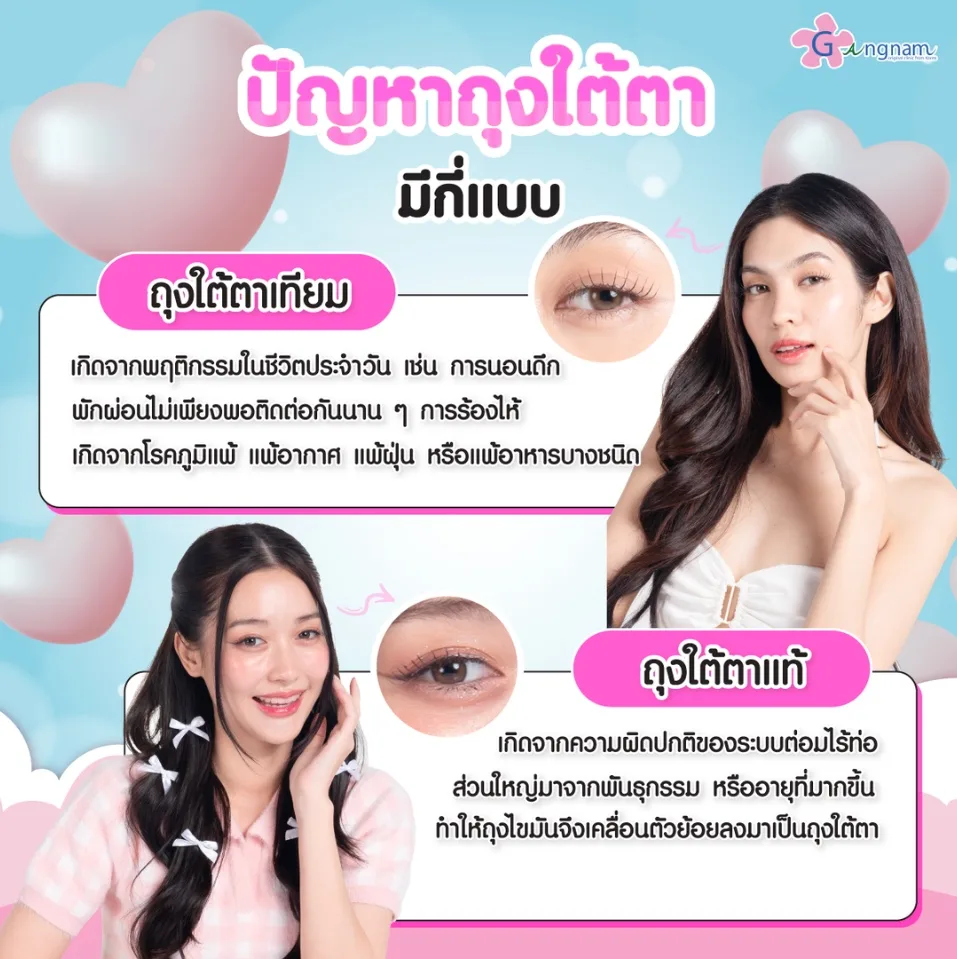 ปัญหาถุงใต้ตามีกี่แบบ