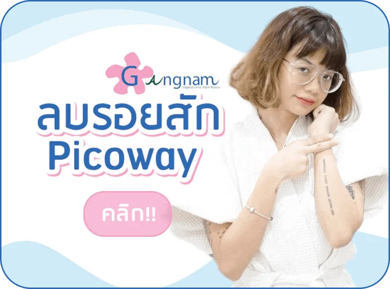 ลบรอยสัก