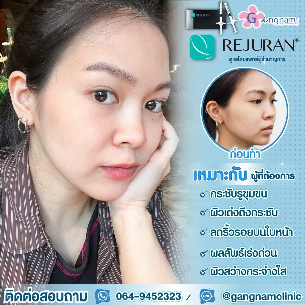 รีจูรัน