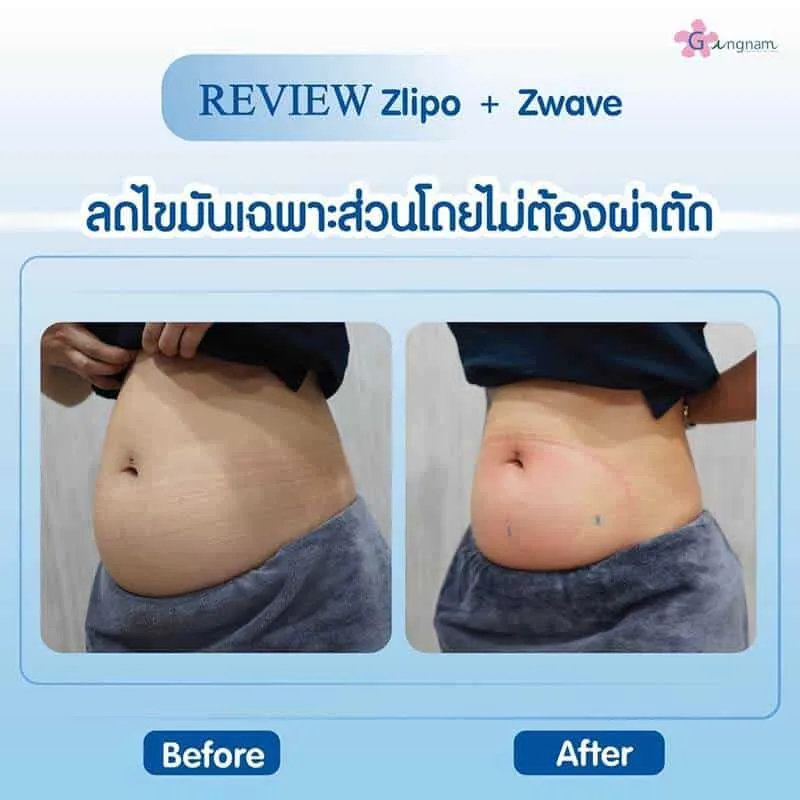 รีวิวลูกค้า 69