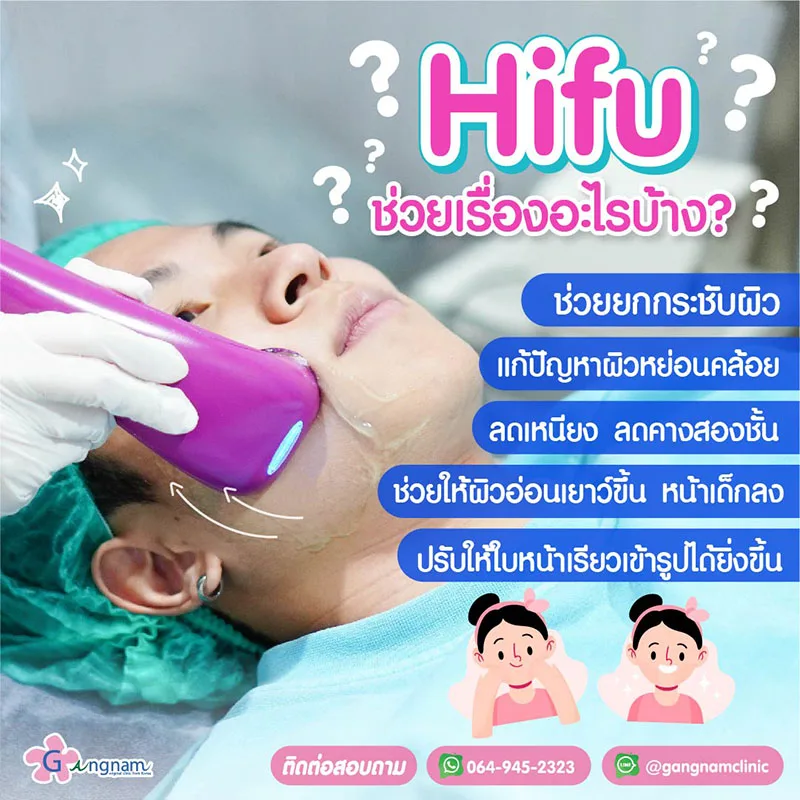 hifu ช่วยเรื่องอะไร