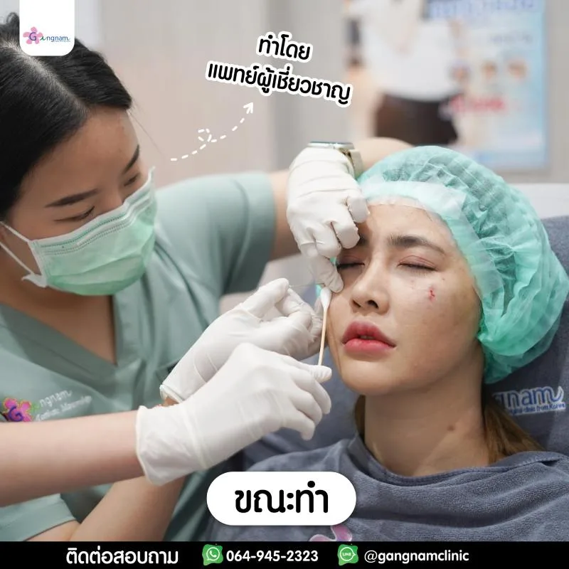 ร้อยไหมใต้ตากับผู้เชี่ยวชาญ