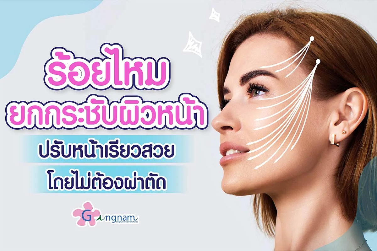 ไขข้อสงสัย! ร้อยไหม คืออะไร? มีข้อดี-ข้อเสียอย่างไรบ้าง ต่างจากการยกกระชับรูปแบบอื่นอย่างไร