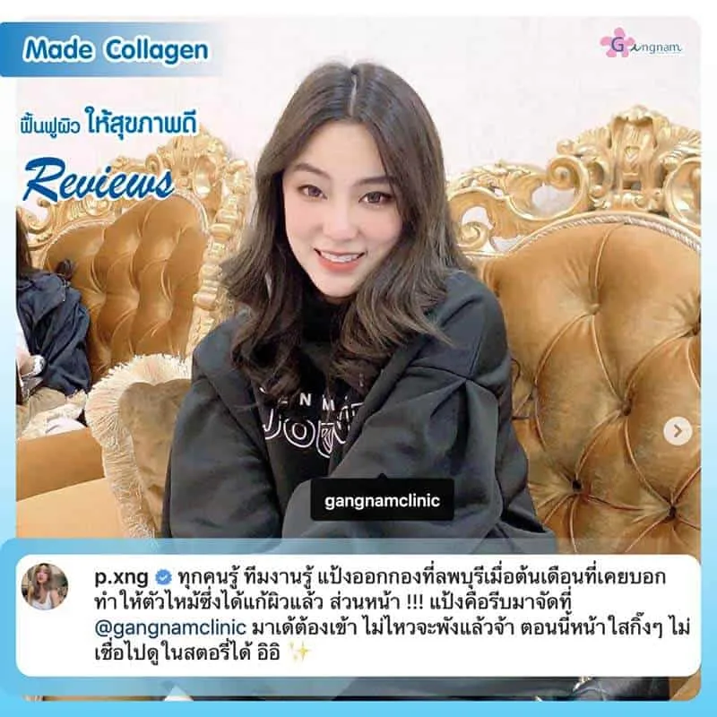 รีวิวฉีดมาเด้คอลลาเจน