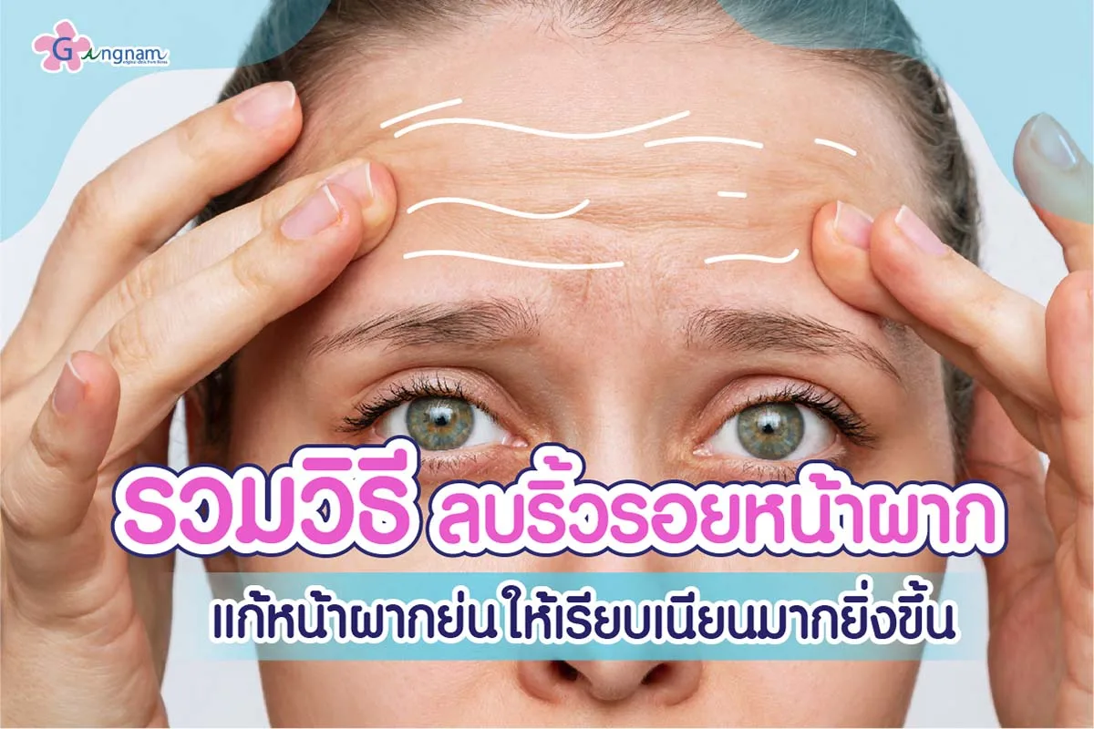 วิธีลดริ้วรอยบนหน้าผาก แต่ละวิธี เหมาะกับใคร พร้อมข้อดี-ข้อเสีย