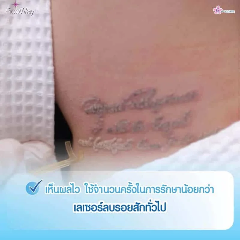 รีวิวลูกค้า 36