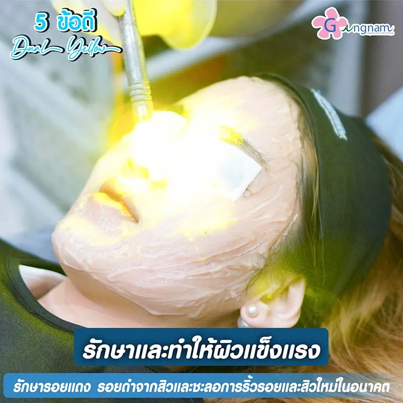 เลเซอร์รอยสิว เหมาะกับใคร
