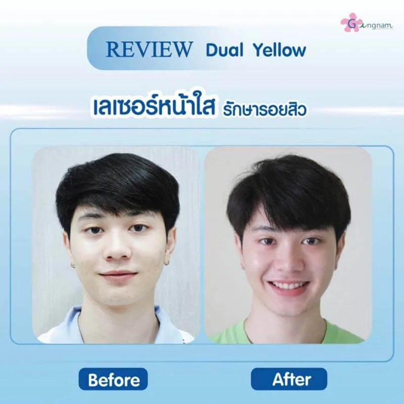 รีวิวลูกค้า 38