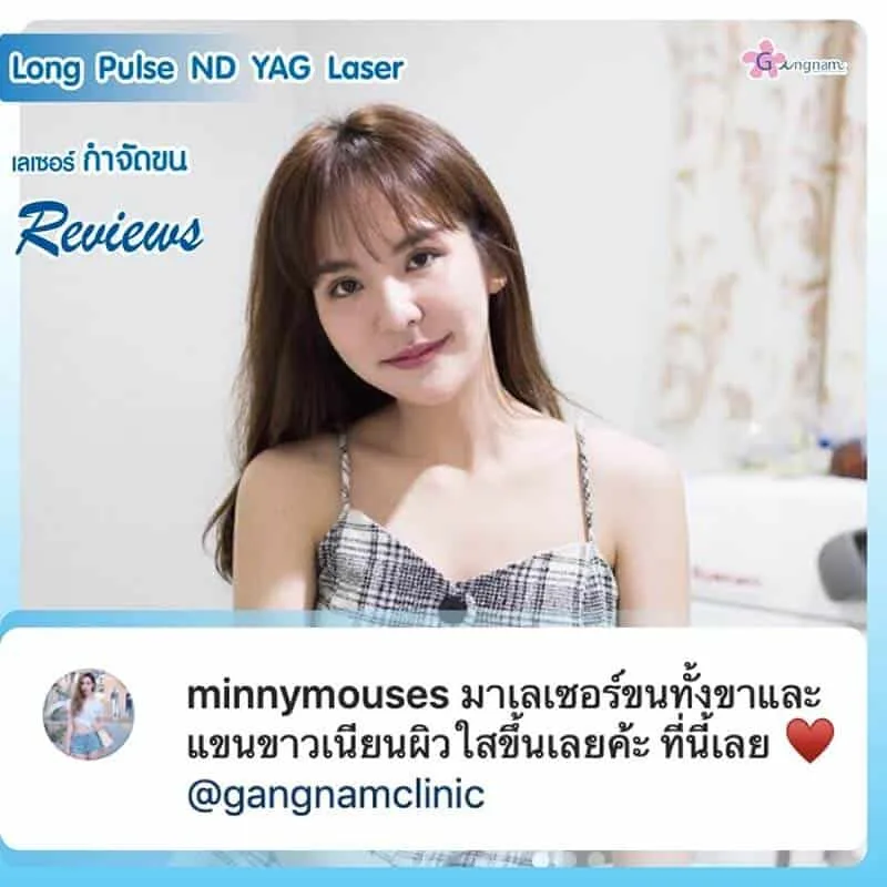 เลเซอร์ขนขาและแขน ให้ขาวเนียน
