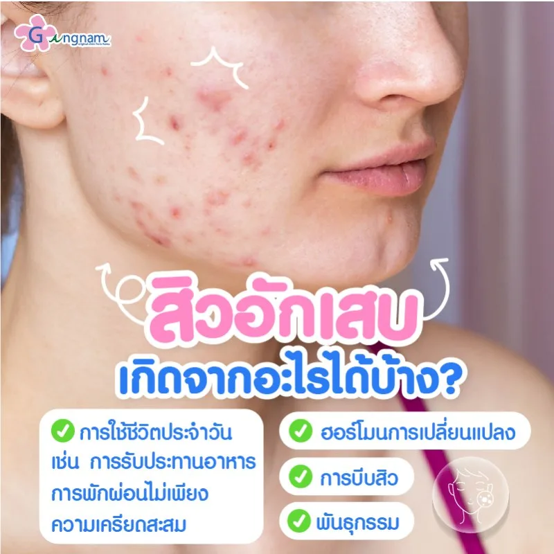 สิวอักเสบ เกิดจากอะไร