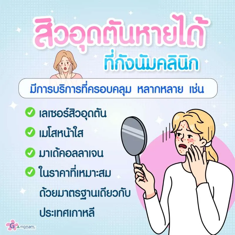 เลเซอร์สิวอุดตัน กับกังนัม