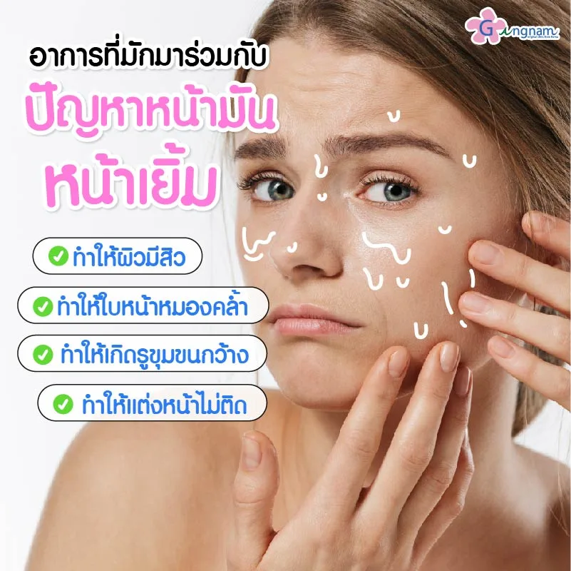อาการที่มาร่วมกับหน้ามัน