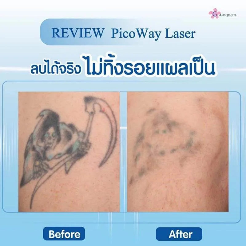 รีวิวลูกค้า 32
