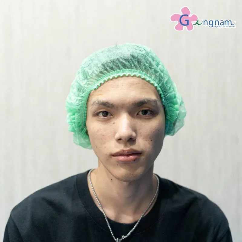 คุณคิวเลอร์ ก่อนทำ