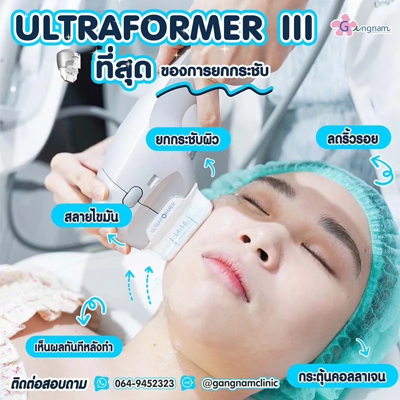 Ultraformer III คืออะไร? ช่วยเรื่องอะไรบ้าง ทำแล้วเห็นผลจริงไหม?