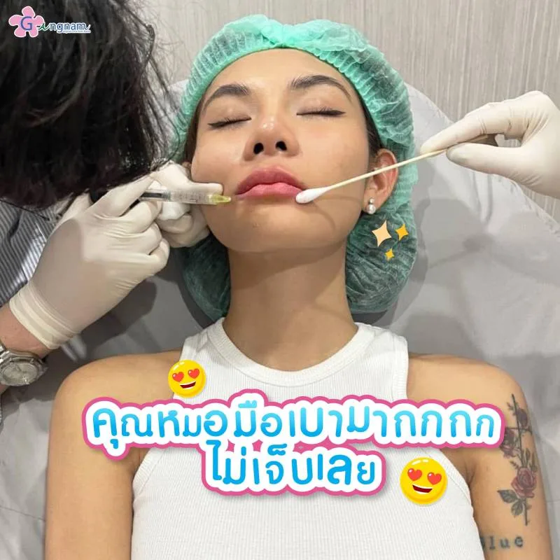 การฉีดฟิลเลอร์ปาก