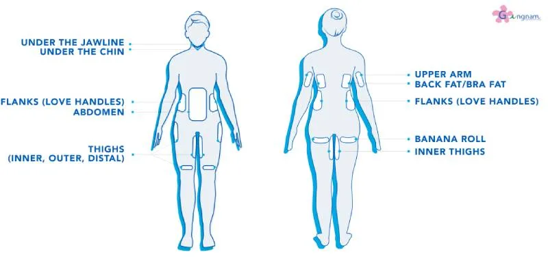 Coolsculpting ทำส่วนไหนได้บ้าง