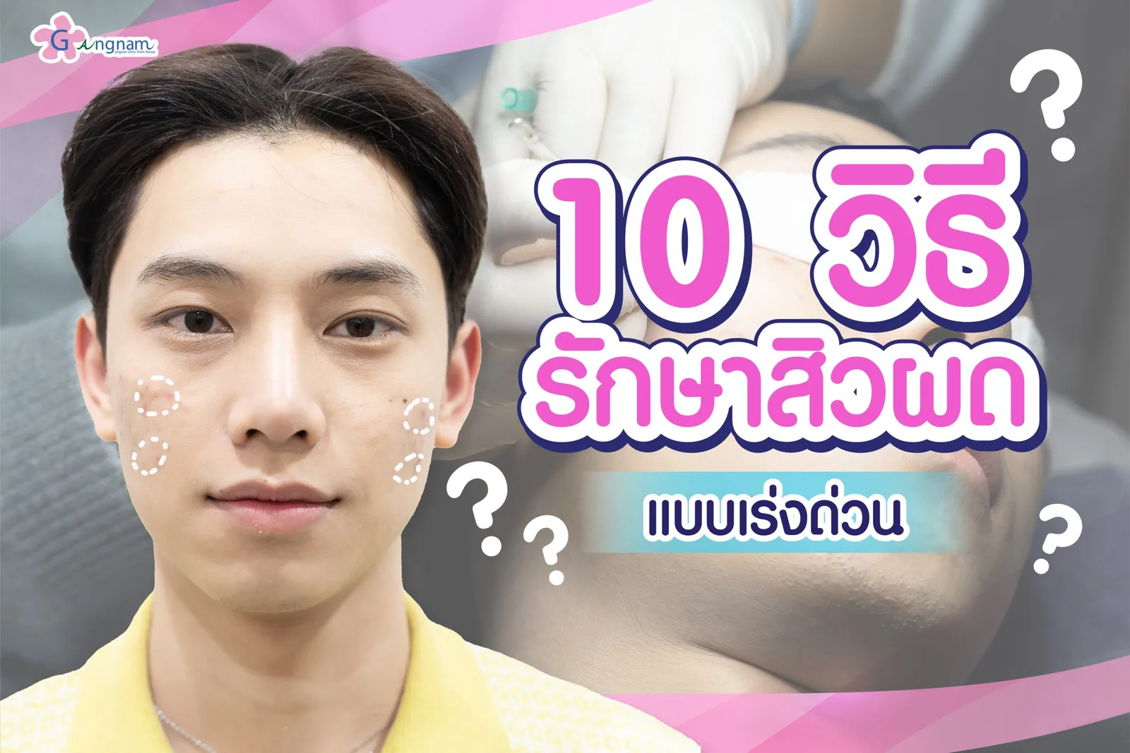 11 วิธีรักษาสิวผด แบบเร่งด่วน ให้หน้ากลับเรียบเนียนอย่างเป็นธรรมชาติ