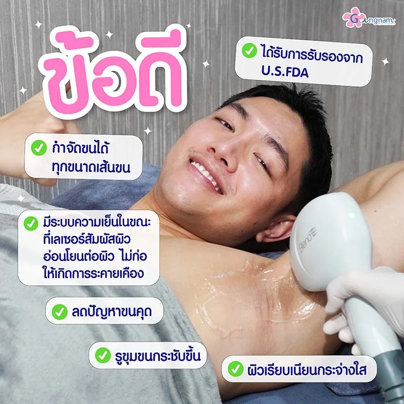 ข้อดีของการกำจัดขนด้วย diode laser