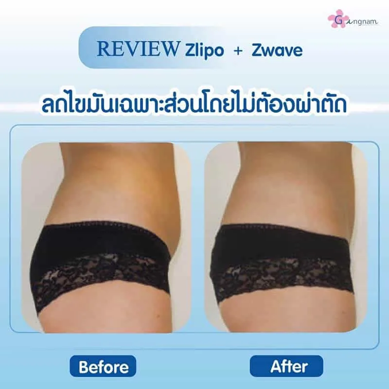 รีวิวลูกค้า 68