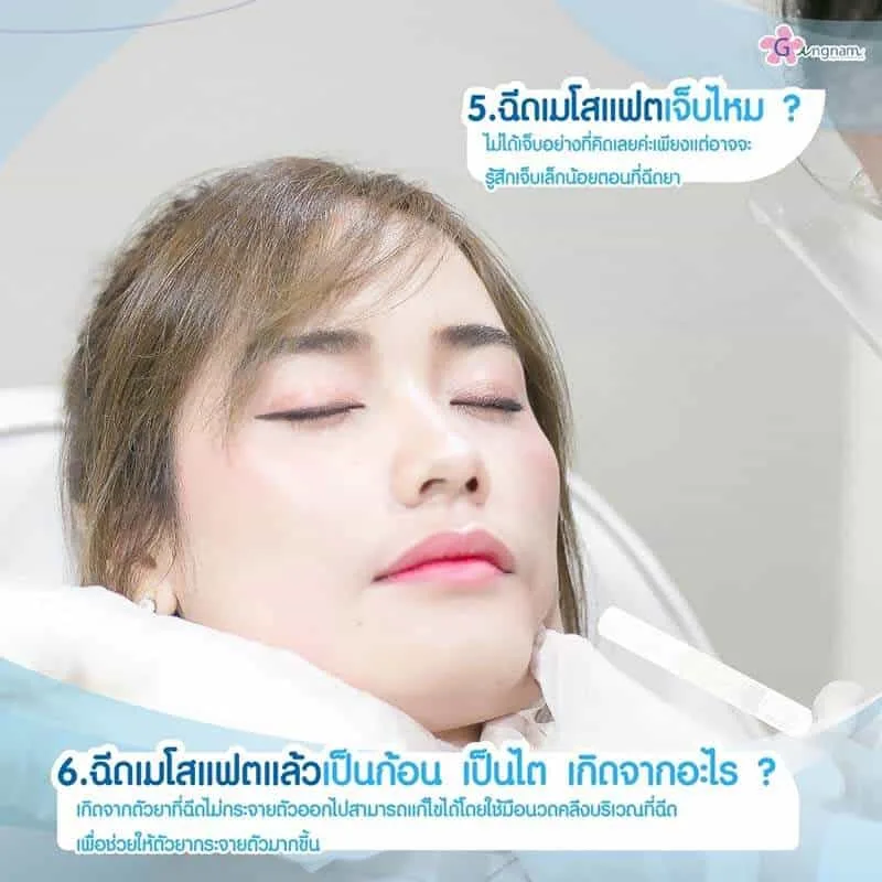 ฉีดเมโสแฟต-มีอาการเจ็บไหม