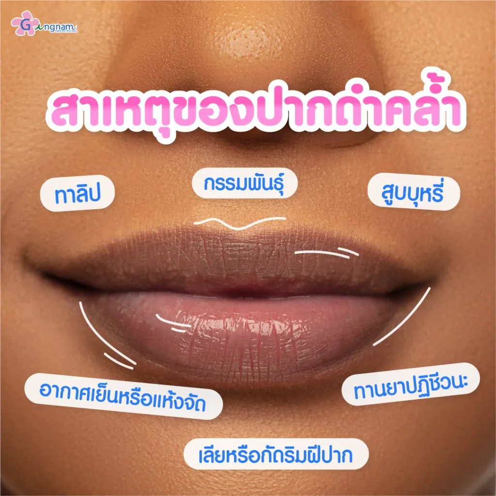 ปากดำเกิดจากอะไร