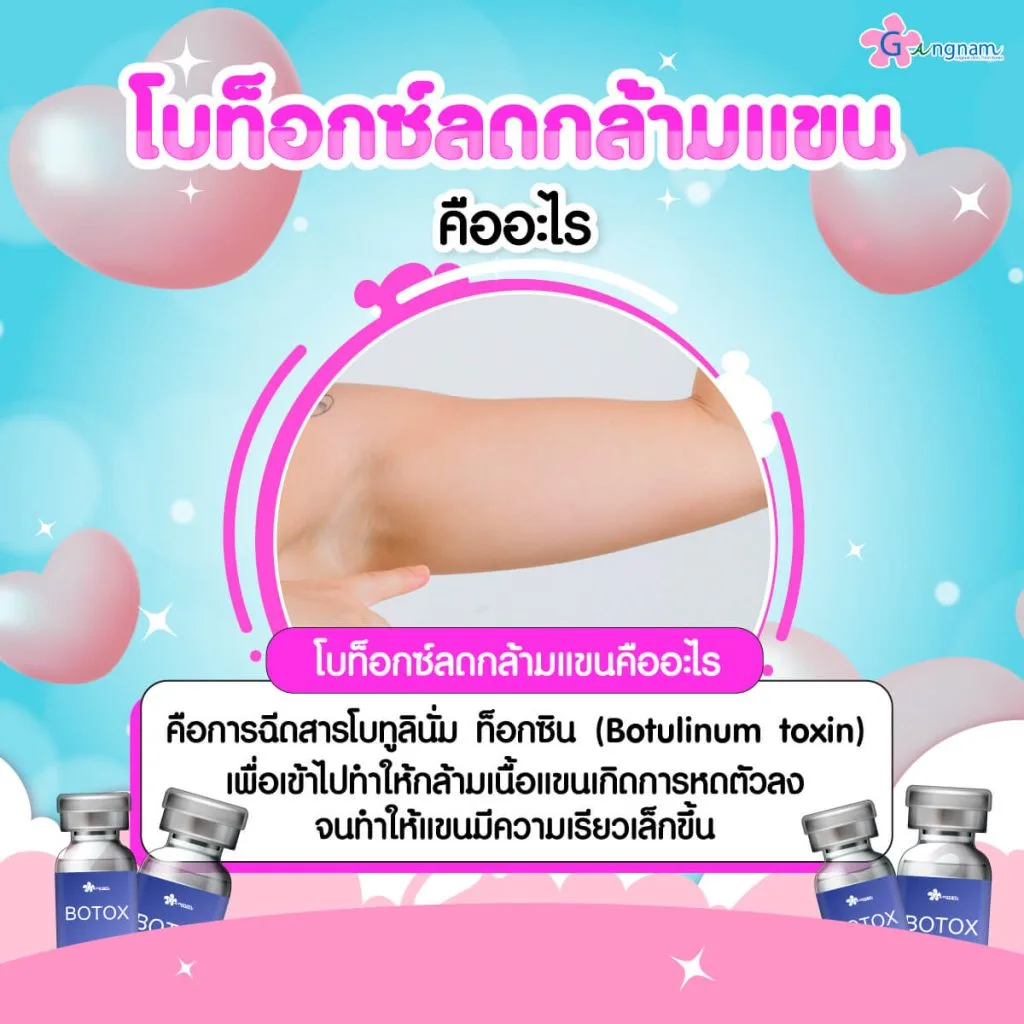 โบท็อกลดกล้ามแขนคือ