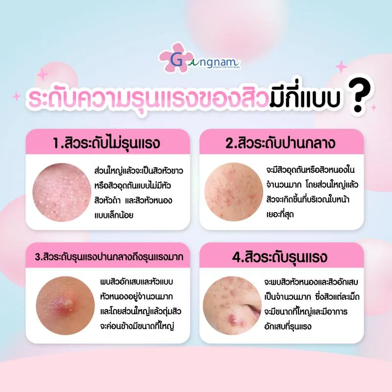 ระดับความรุนแรงของสิวมีกี่แบบ