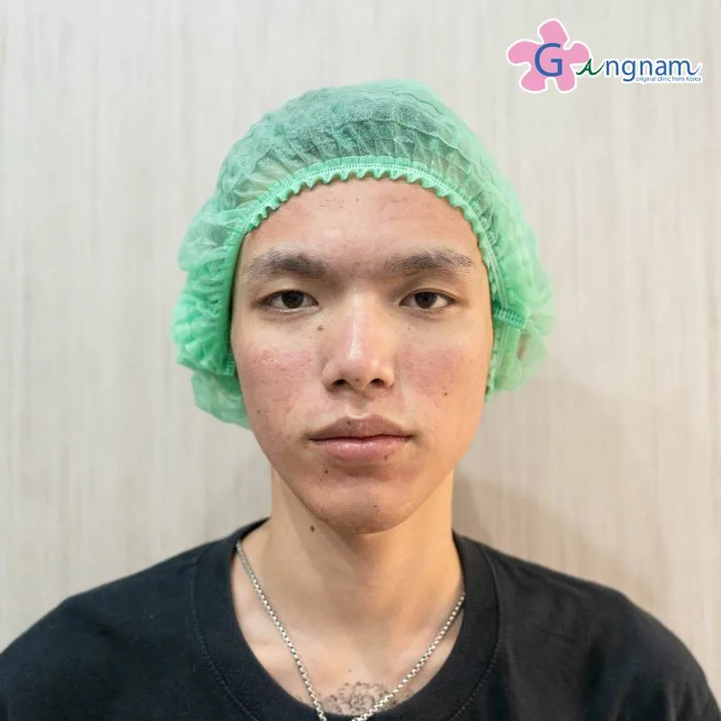 คุณคิวเลอร์ หลังทำทันที
