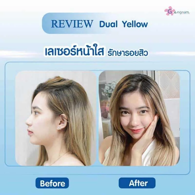 รีวิวลูกค้า 44