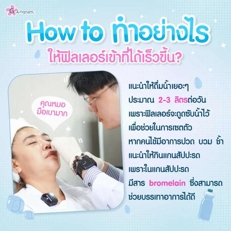 ทำอย่างไรให้ฟิลเลอร์เข้าที่เร็วขึ้น