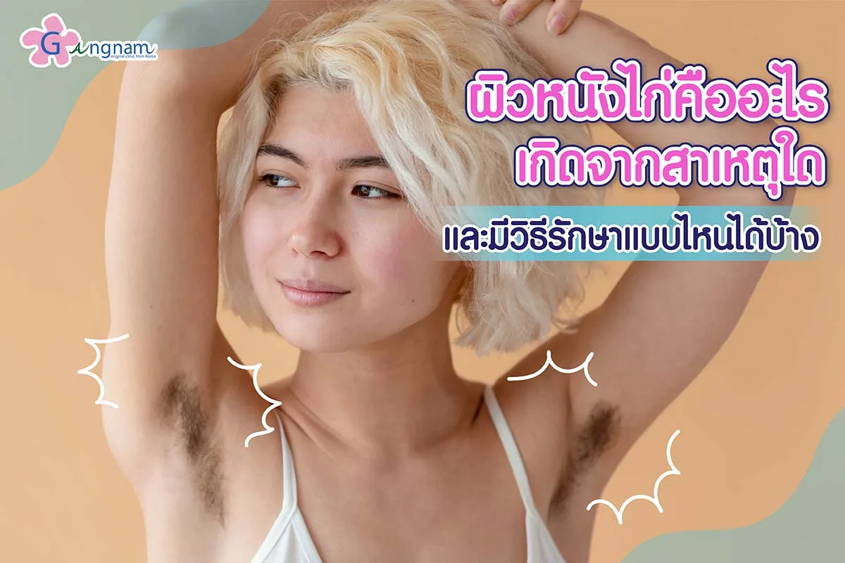 ผิวหนังไก่ คืออะไร? เกิดจากสาเหตุใด? มีวิธีรักษาแบบไหนได้บ้าง