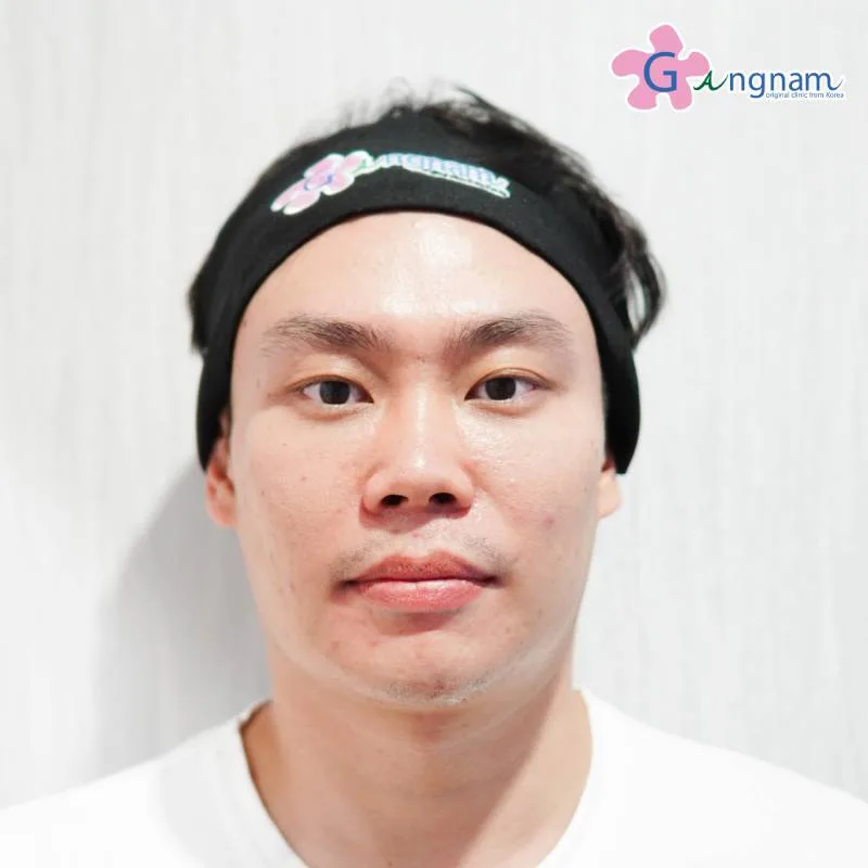 คุณไปร์ท ก่อนทำ