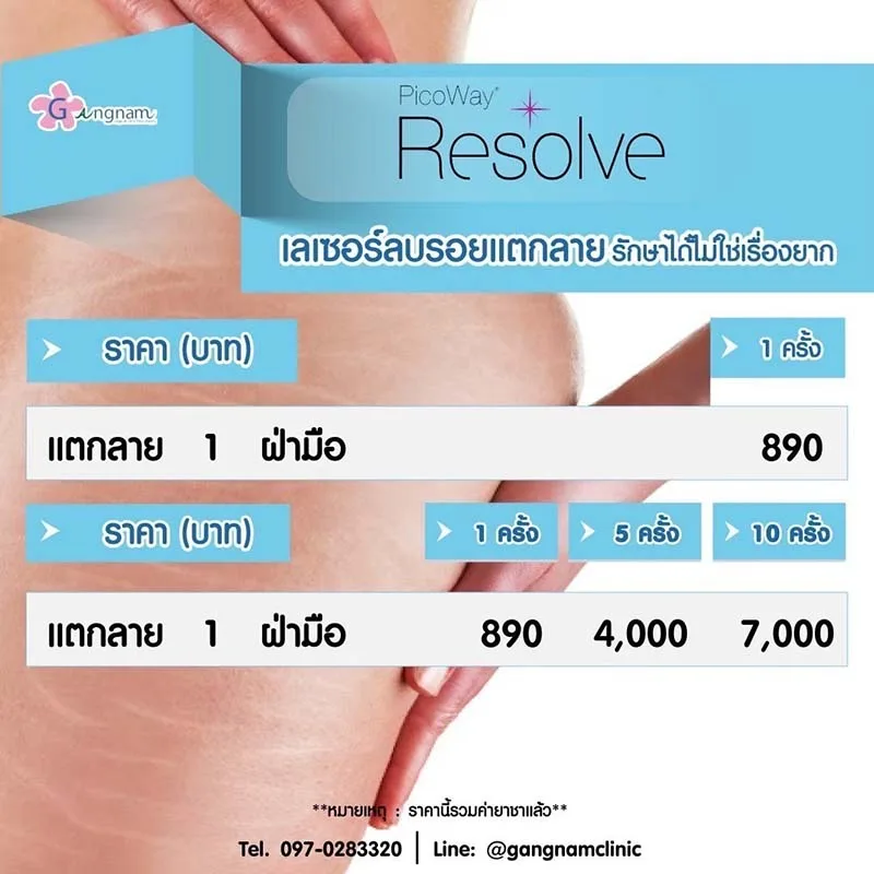 เลเซอร์รอยแตกลาย ราคา