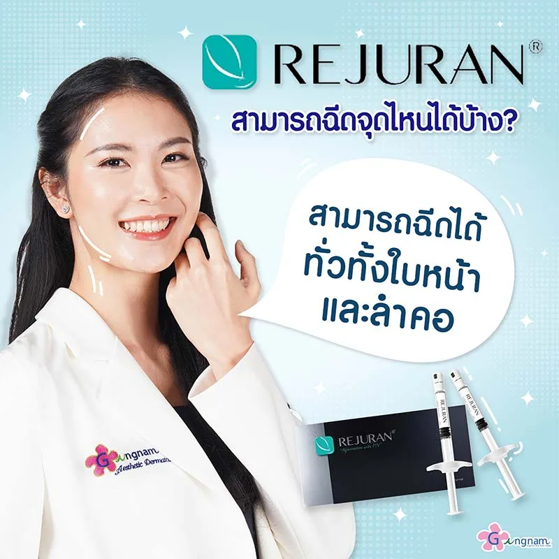 รีจูรัน ฉีดจุดไหนได้บ้าง